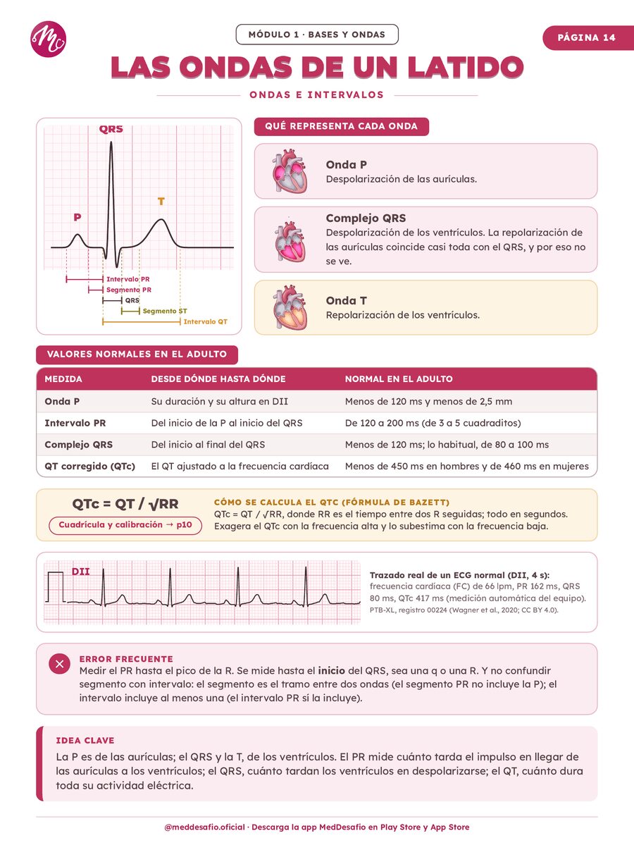 Las ondas de un latido: P, QRS y T sobre un trazado real