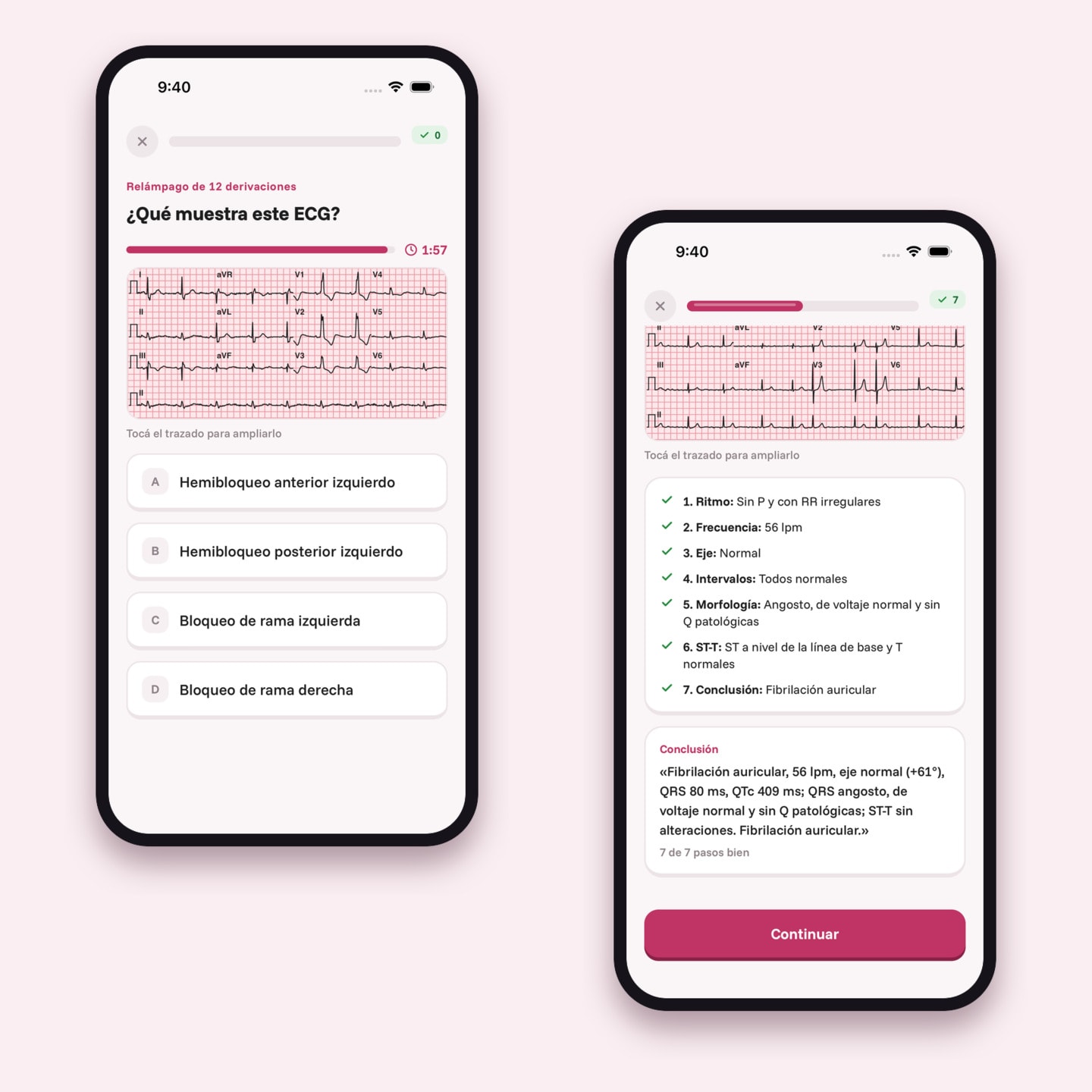 La app MedDesafio: una pregunta con un ECG de 12 derivaciones y la lectura en 7 pasos